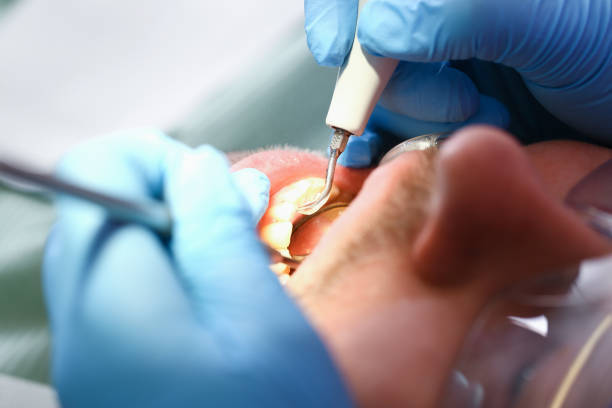 Best Weekend Emergency Dentist in Fort Clark Springs, TX